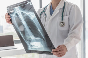 What Are the Most Common Medical Errors?